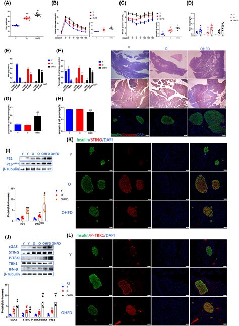Cgas‐sting Mediates Cytoplasmic Mitochondrial‐dna‐induced Inflammatory