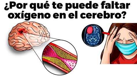 11 razones por las que te podría faltar oxígeno en el cerebro YouTube