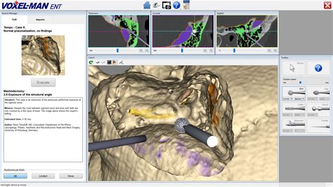 Voxel Man Tempo Virtueller Ohrchirurgie Simulator
