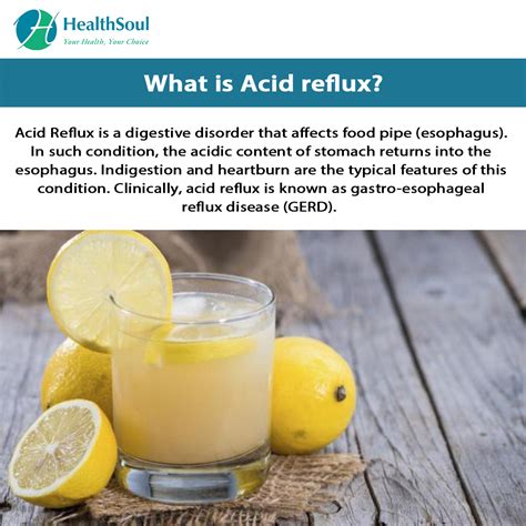 Natural Treatment For Acid Reflux Healthsoul