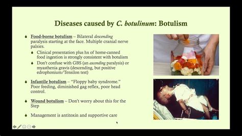 Clostridium Botulinum Botulism Microbiology Boot Camp Youtube
