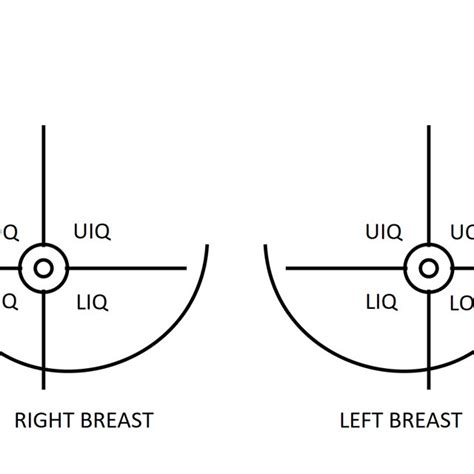 The breast can be divided into four quadrants. Left Lower Quadrant Definition - ovulation symptoms