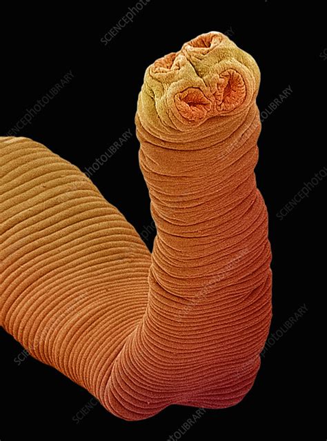 The Head Of The Tapeworm Stock Image C0052036 Science Photo Library