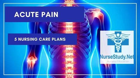 Solution Nursing Care Plan Acute Pain Ncp Studypool T Vrogue Co