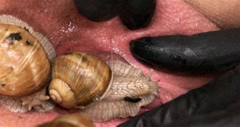Pussy Torture With Snail