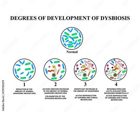 4 Degrees Of Development Of Dysbiosis Dysbacteriosis Of The Intestine