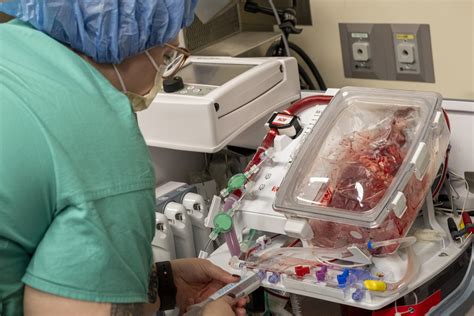 Multicenter Trial Finds Using Circulatory Death Donors Is Safe And Effective For Heart