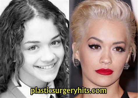Rita Hayworth Before Plastic Surgery