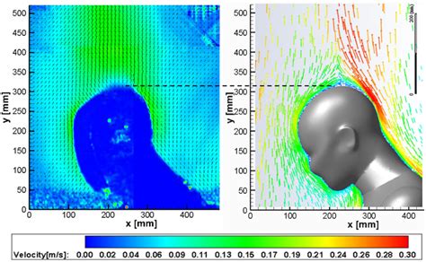 Velocity Vectors For The Surgeon Left Piv Measurements Right Cfd