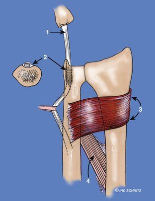 Stability Of The Distal Radioulnar Joint Clinical Gate