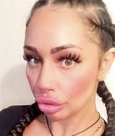This Woman Wants To Take Her Huge Lips And Make Them Even Bigger Others