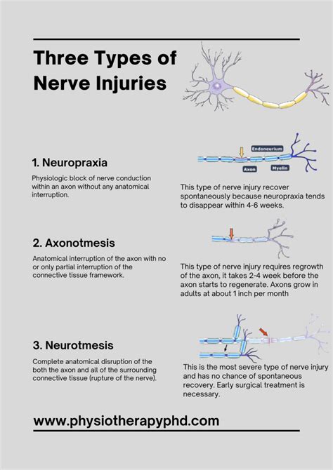 Types Of Nerve Injuries Enrich Your Skills