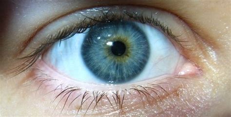 How To Know If My Eyes Are Green Hazel Or Central Heterochromia Quora