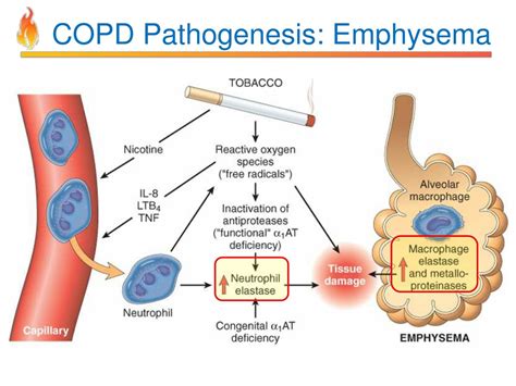 Clinical Features Of Copd Ppt Download From Link Pelajaran