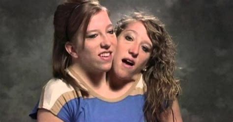 Content licensed from figure 8 films. 10 Interesting Stories Of Conjoined Twins - Listverse