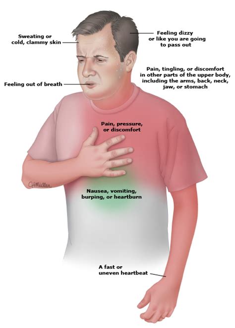 Some heart attacks are sudden and intense. Heart attack symptoms PI