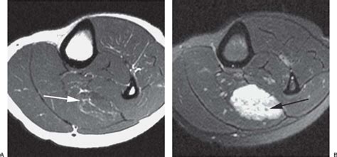 Human anatomy for muscle, reproductive, and skeleton. Soft-Tissue and Bone Tumors | Radiology Key