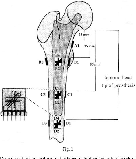 Figure 1 From Strain Distribution In The Proximal Human Femur An In