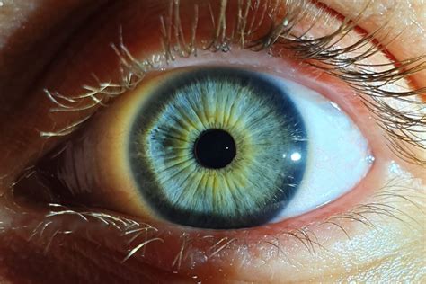 Pupilas Puntiformes O Miosis ¿por Qué Ocurre — Mejor Con Salud