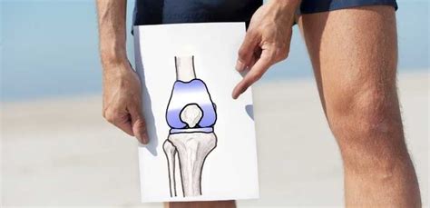 Physical Therapy For Total Knee Arthroplasty Latham Saratoga Queensbury