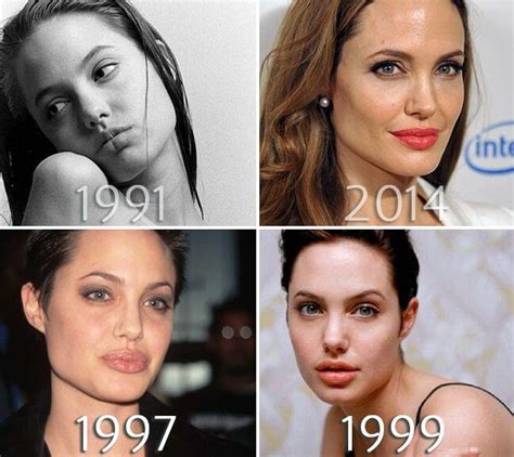 Angelina Jolie Lips Before And After Photo Angelina Jolie Plastic