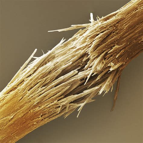 Damaged Human Hair Shaft Sem Photograph By Science Photo Library