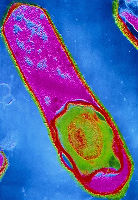 Morphology of clostridium perfringens (clostridium welchii). Clostridium Perfringens Bacterium With Spore Photograph by ...