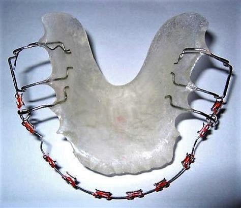 Pin By John Beeson On Orthodontic Retainers Fake Braces Getting Braces Clear Retainers