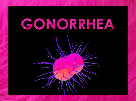 Gonorrhea PULSE CLINIC Asia S Leading Sexual Healthcare Network