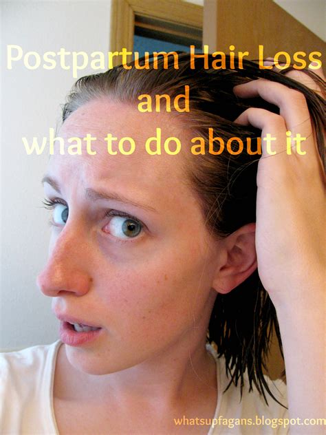 Postpartum Hair Loss And How To Deal With It