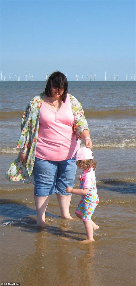 Obese Mother Who Would Consume 5000 Calories A Day Sheds Half Her Body