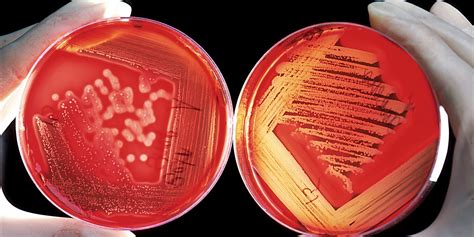 Histeria Monocytogenes Lo Que Debemos Saber De La Listeria Visto De
