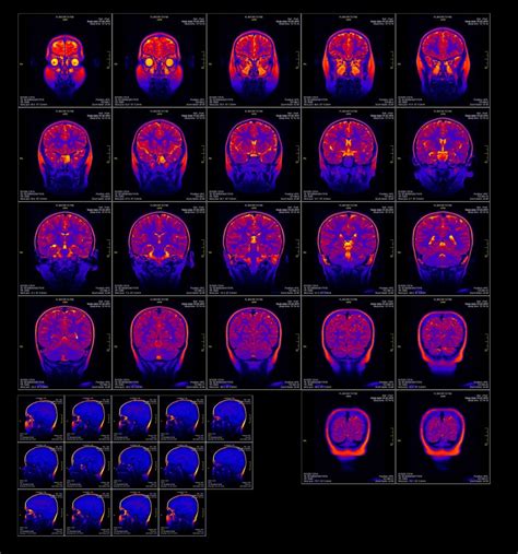 Functional Magnetic Resonance Imaging Neura Library