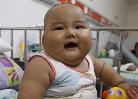 Obesidad Infantil Una Epidemia Que Recorre El Mundo 41 Millones De