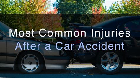 Most Common Auto Accident Injuries Youtube