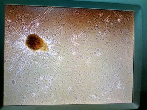 Is This Be A Fungalbacteria Contamination In Ips Cell Culture