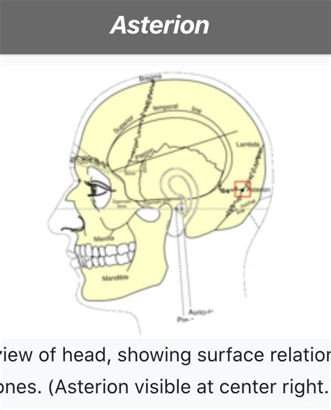 The Frontal View Of Head Showing Surface Relations With Bones Asterion