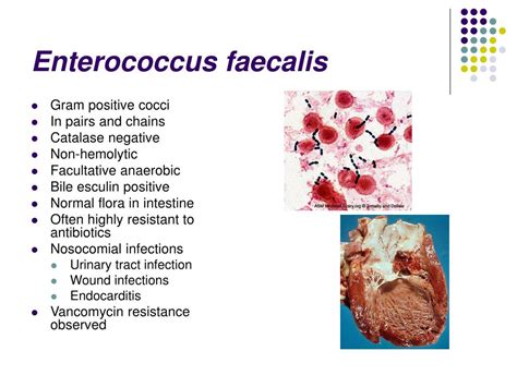Enterococcus Faecalis Vs Faecium