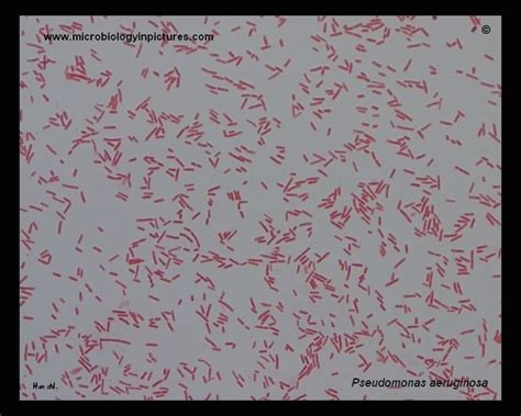 Pseudomonas Aeruginosa Gram Stain Gram Stained Cells Of Pseudomonas