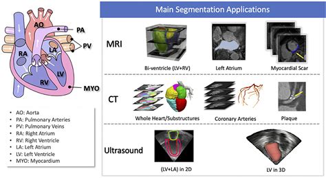 Deep Learning For Medical Image Segmentation Vrogue