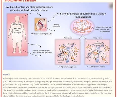 Sleep Disorders Sleep Disordered Breathing Alzheimers Disease Bedroom