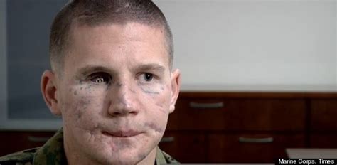 Marine Who Was Severely Injured Protecting Friend To Receive Highest