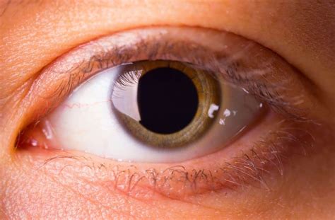 What Prescribed And Nonprescribed Drugs Cause Dilated Pupils Garden