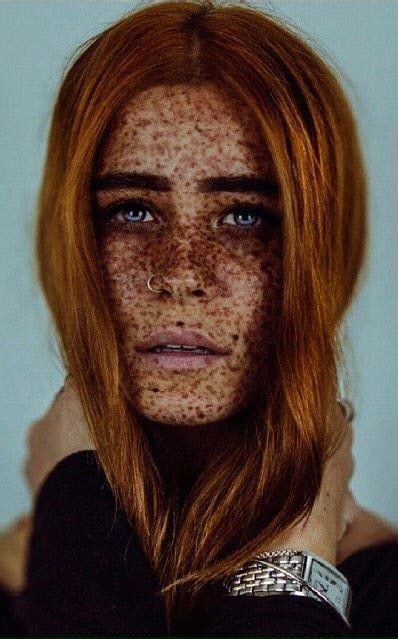 a woman with freckles on her face