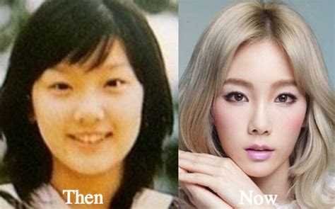 Snsd Plastic Surgery Before And After Snsd 2020