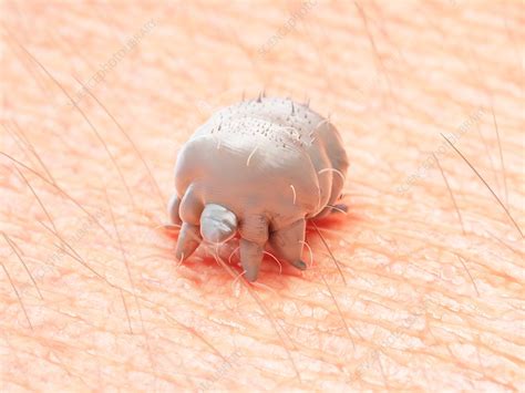 Illustration Of A Scabies Mite Stock Image F0237759 Science