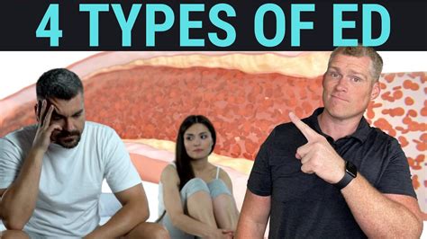 Types Of Ed Erectile Dysfunction Which Type You Have Why It Matters Youtube