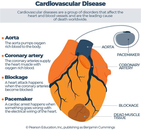 cardiovascular disease infographic