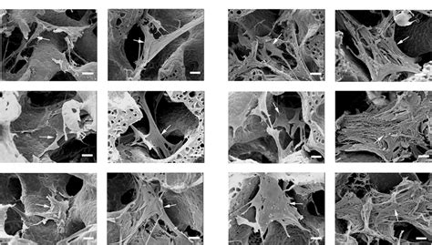 Microscope Human Bone Cells Micropedia