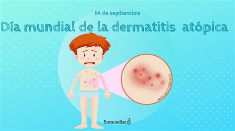 D A Mundial De La Dermatitis At Pica Somosdisc